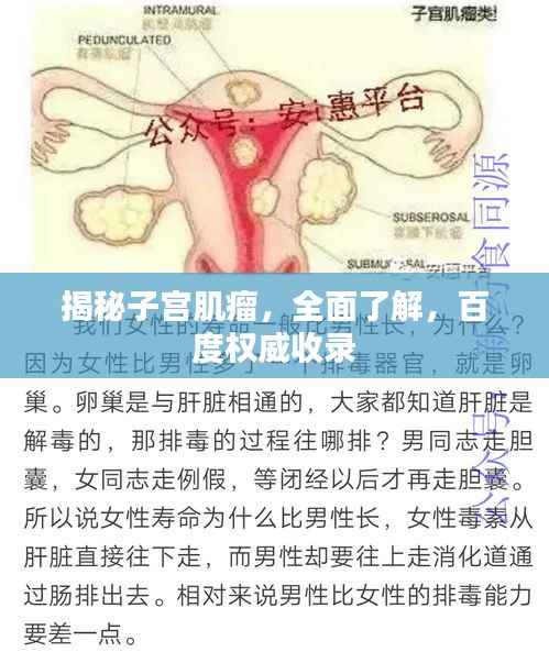 揭秘子宫肌瘤，全面了解，百度权威收录