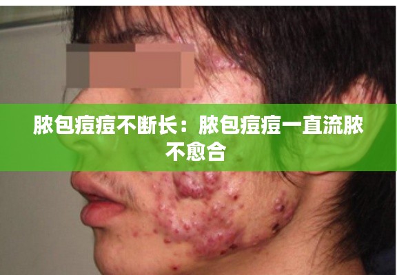 脓包痘痘不断长:脓包痘痘一直流脓不愈合