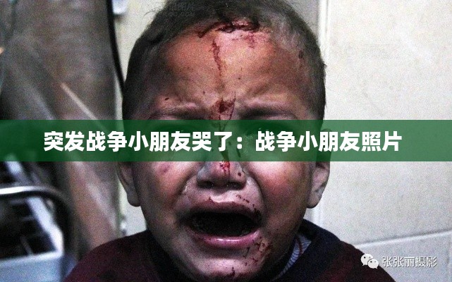 突发战争小朋友哭了：战争小朋友照片 