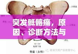 突发骶髂痛，原因、诊断方法与治疗策略