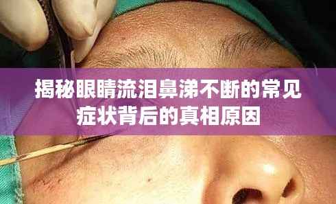 揭秘眼睛流泪鼻涕不断的常见症状背后的真相原因