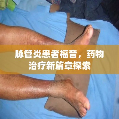 脉管炎患者福音，药物治疗新篇章探索