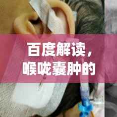 百度解读,喉咙囊肿的症状与解析