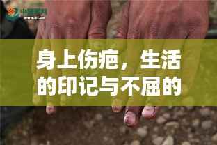 身上伤疤，生活的印记与不屈的力量