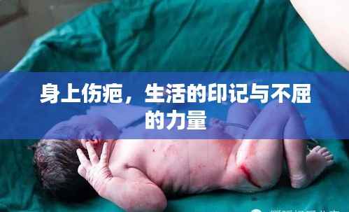 身上伤疤,生活的印记与不屈的力量