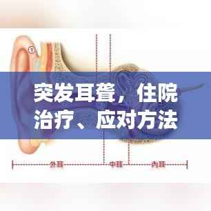 突发耳聋，住院治疗、应对方法与康复指南