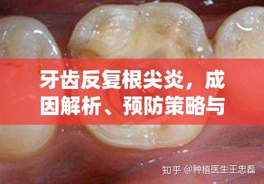 牙齿反复根尖炎，成因解析、预防策略与治疗方法